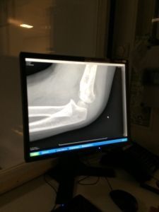 2015-09-18 Chloe breekt haar arm12
