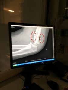 2015-09-18 Chloe breekt haar arm12b